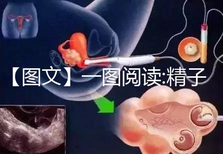 【圖文】一圖閱讀:精子和卵子結合有多難！