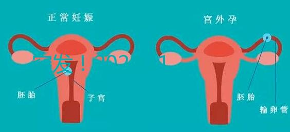 突發(fā)!2024.11.15,天津試管嬰兒納入醫(yī)保報銷(附14家醫(yī)保定點醫(yī)院)