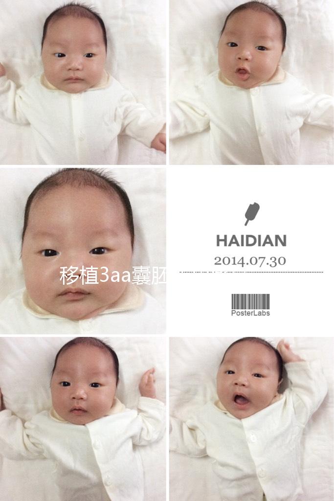 移植3aa囊胚成功率高嗎?詳解質(zhì)量等級(jí)助孕更放心