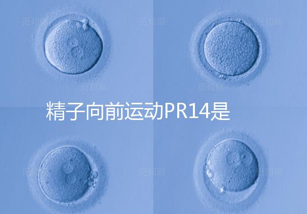 精子向前運動PR14是否正常聽專家怎么說，當心弱精找上門