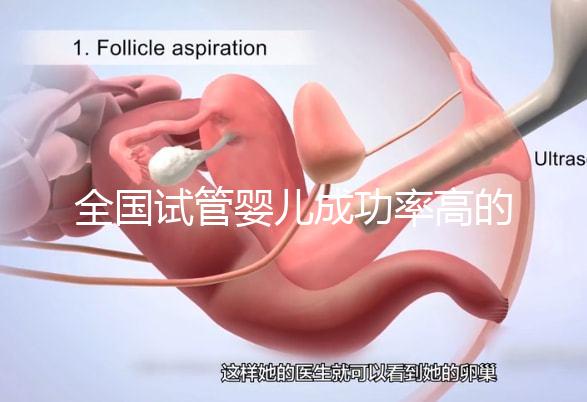 全國試管嬰兒成功率高的醫院排名，內附2023試管費用及成功率參考