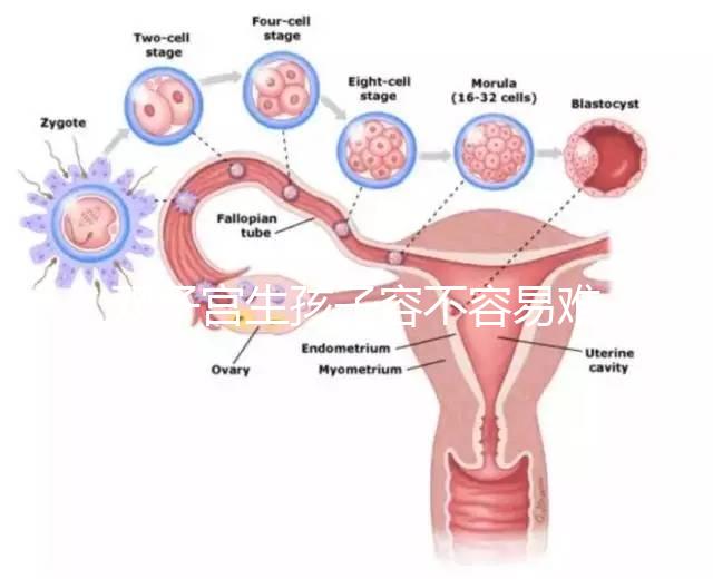 雙子宮生孩子容不容易難產看情況，注意這幾點也能順利抱娃