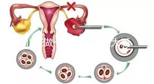 北京做一次試管嬰兒大概花多少錢？2025年價格及明細清單一覽！