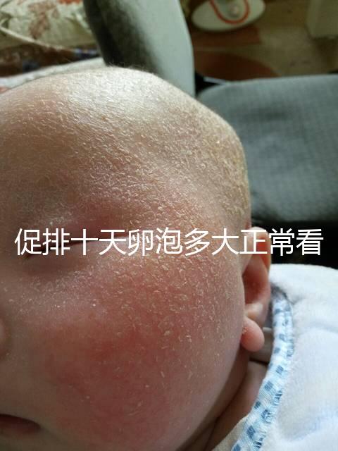 促排十天卵泡多大正?？催@，1.1×0.9符不符合一文說清