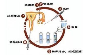 代試管嬰兒和第二代試管嬰兒的區別，基因篩查技術！