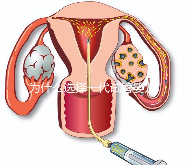為什么選擇一代試管嬰兒？全面解析其獨(dú)特優(yōu)勢(shì)與適用場(chǎng)景