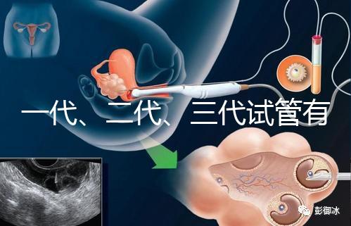 一代、二代、三代試管有什么區(qū)別?