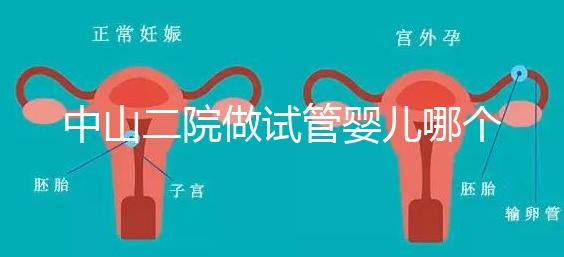 中山二院做試管嬰兒哪個醫生好？附醫院試管成功率