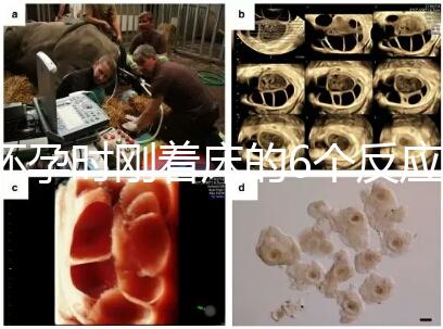 懷孕時(shí)剛著床的6個(gè)反應(yīng)，同房后這個(gè)時(shí)候觀察身體最準(zhǔn)