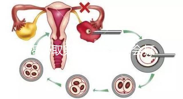 揭秘取卵后醫生會不會打電話問選幾代？這些問題會涉及到