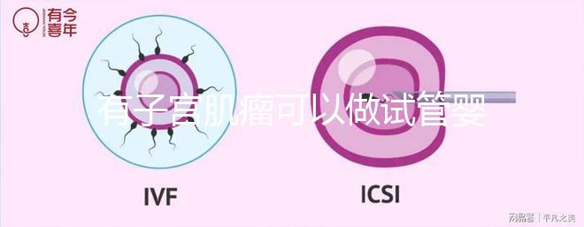 有子宮肌瘤可以做試管嬰兒嗎（有子宮肌瘤可以做試管嬰兒嗎多少錢）