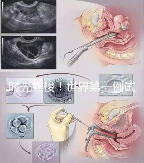 時光如梭！世界第一例試管嬰兒路易絲·布朗已經(jīng)41歲啦