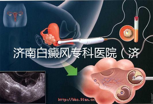 濟南白癜風?？漆t院（濟南白點癲風醫院排名）