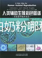 水解蛋白奶粉哪種好？口感和消化分析這個(gè)品牌出彩