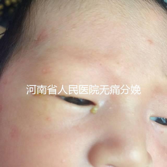 河南省人民醫院無痛分娩多少錢戳，收費標準60s看懂不踩坑