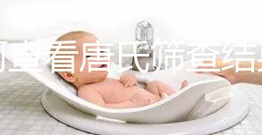 如何查看唐氏篩查結(jié)果，珠海醫(yī)院價(jià)格二百四起