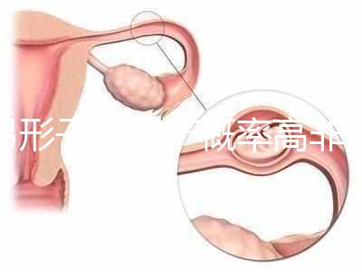 弓形子宮流產概率高非個例！罪魁禍首是這個原因