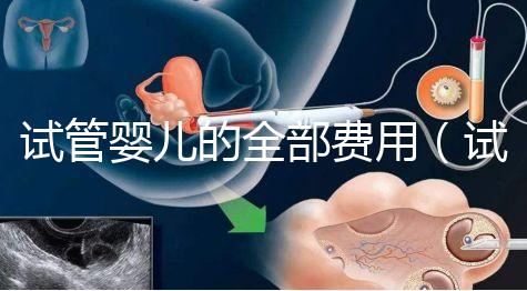 試管嬰兒的全部費(fèi)用（試管嬰兒的全部費(fèi)用大概是多少重慶安琪兒電話）