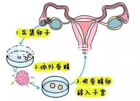 試管嬰兒二超后減藥原因已找到，對(duì)胎兒沒影響別瞎擔(dān)心