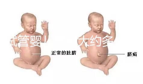 試管嬰兒費用大約多少2021(試管嬰兒費用大約多少2021年鄭州)