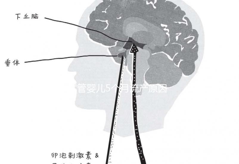 試管嬰兒5個月流產原因有三,多久能再次移植需慎重考慮