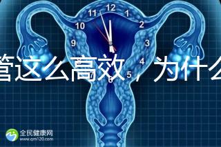 試管這么高效，為什么醫生還推薦人工授精？