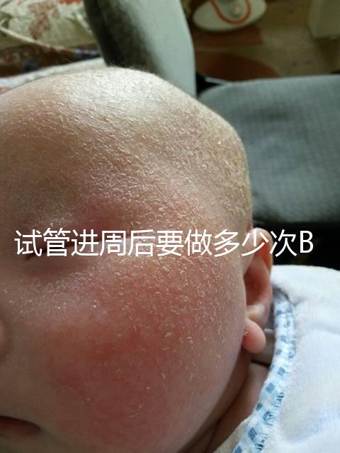 試管進周后要做多少次B超？需要檢查什么？進來看看