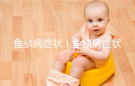 魚(yú)鱗病癥狀(魚(yú)鱗病癥狀及表現(xiàn))