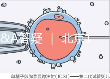 Q&A答疑 ｜ 北京16項輔助生殖技術(shù)進醫(yī)保，試管可以報銷嗎？