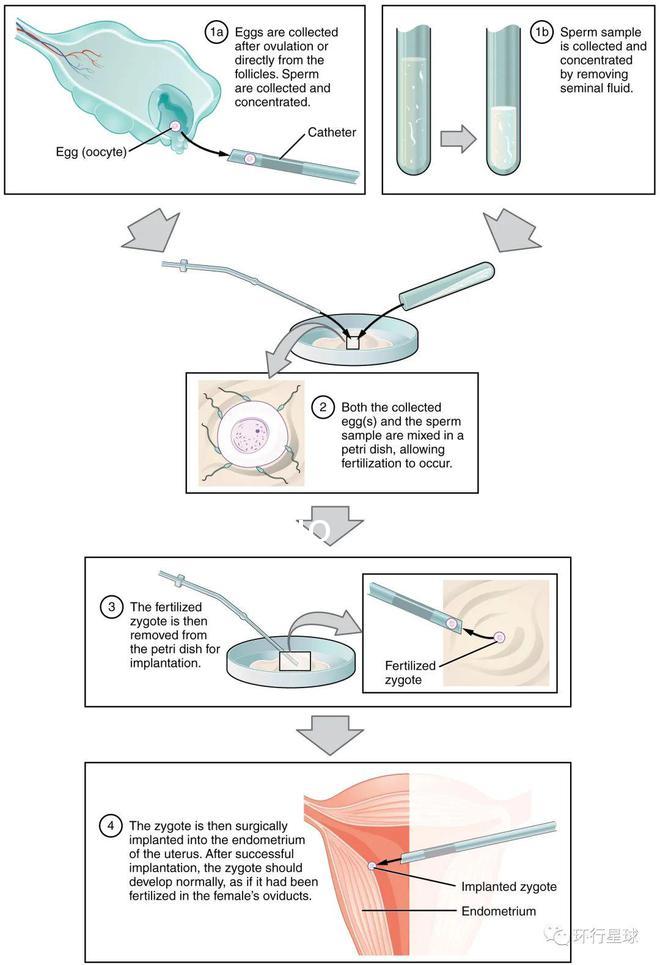Reprod. Biomed：奇跡、突破、爭議、反思——“試管嬰兒”40年