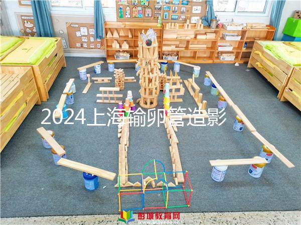 2024上海輸卵管造影檢查多少錢速覽，關鍵看能否報銷